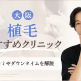 植毛大阪おすすめクリニック