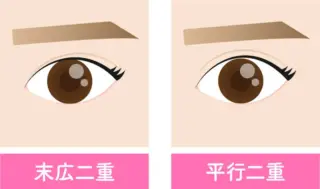 レビアスクリニック 二重 埋没法