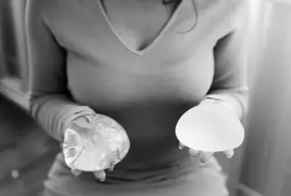 レビアスクリニック シリコンバッグによる豊胸