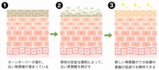 L’amour clinic Tokyo ピーリング