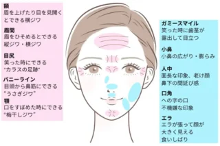 海老名皮膚科・美容皮膚科ボトックス