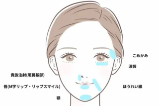 海老名皮膚科・美容皮膚科ヒアルロン酸