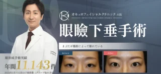 オキュロフェイシャルクリニック　眼瞼下垂手術の施術メニュー画像