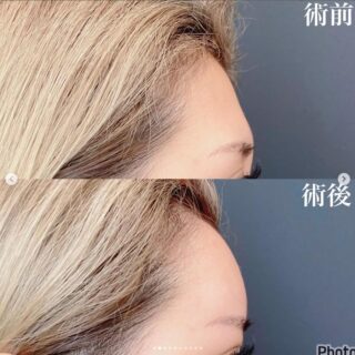 額（ボリューマ）