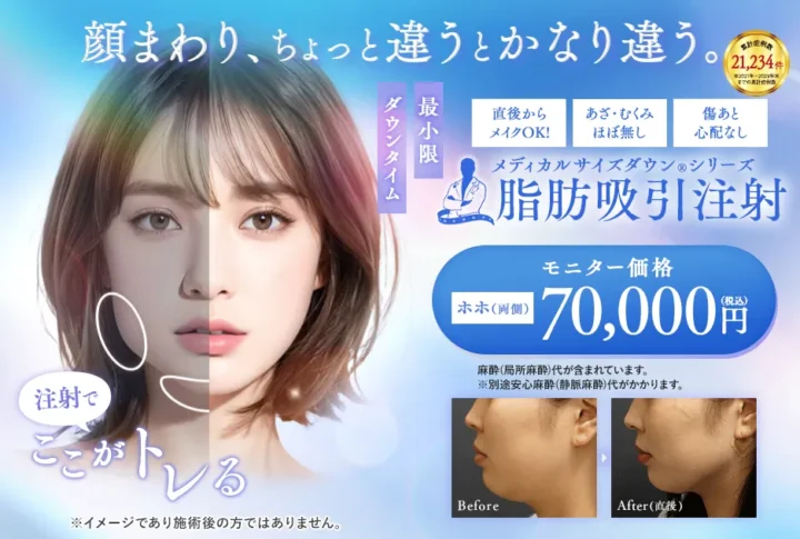 湘南美容クリニック脂肪吸引注射