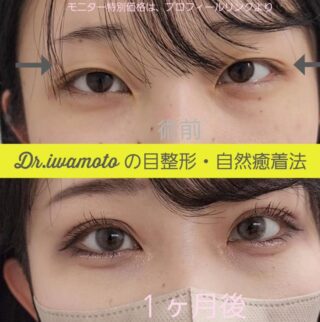 エターナル二重術