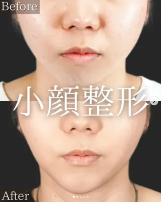 TCB式⼩顔美肌再⽣
