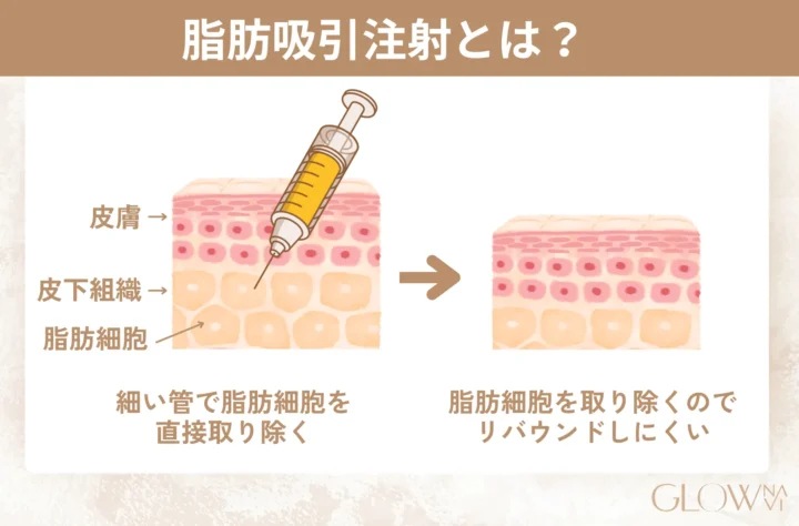 脂肪吸引注射説明