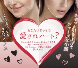 東京美容外科　糸リフトバナー