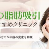 顔の脂肪吸引おすすめ