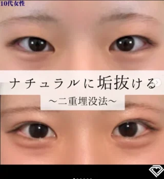 TCB式1dayクイックアイ　ナチュラル