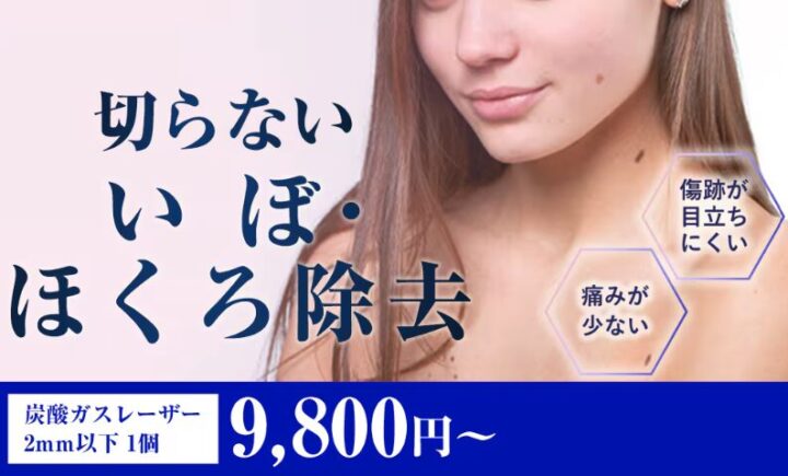 湘南美容クリニック　いぼ・ホクロ除去バナー