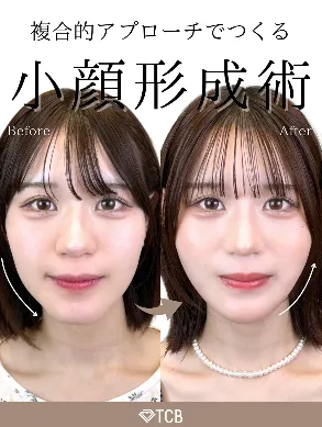 TCB式⼩顔美肌再⽣