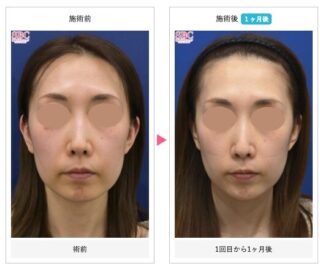 プロファイロ【美容皮膚科】