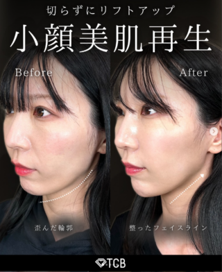 TCB式⼩顔美肌再⽣