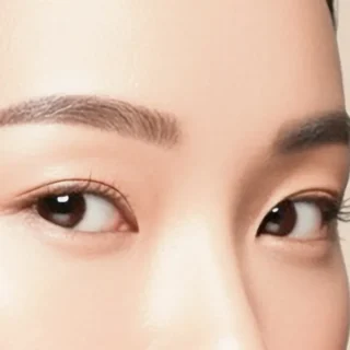 Kclinic_目元施術_施術メニュー画像