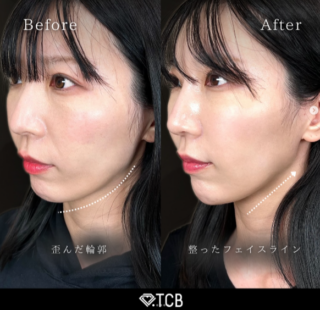 TCB式⼩顔美肌再⽣