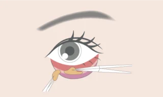 J CLINICクマ取り画像