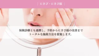 河合医院美容皮膚科ニキビ跡バナー