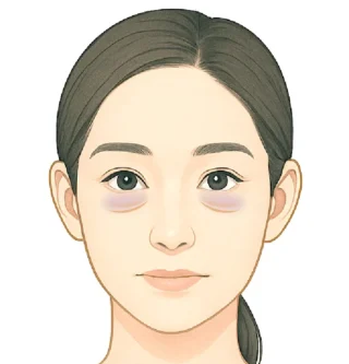 テラクリニック　脱脂（目の下のクマ・たるみ取り）