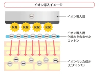 テラクリニック　イオン導入